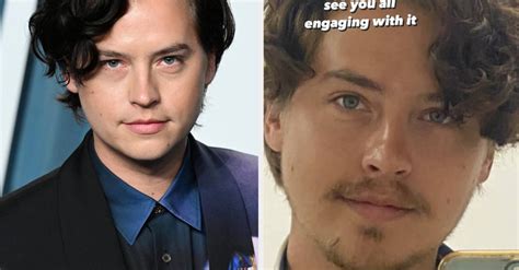 Cole Sprouse Responds To People Dragging His Foot Photo